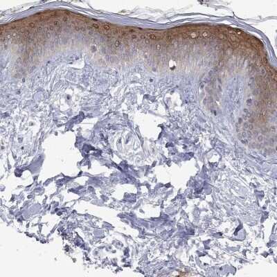 Immunohistochemistry-Paraffin: ICAT/CTNNBIP1 Antibody [NBP3-17057] - Staining of human skin shows high expression.