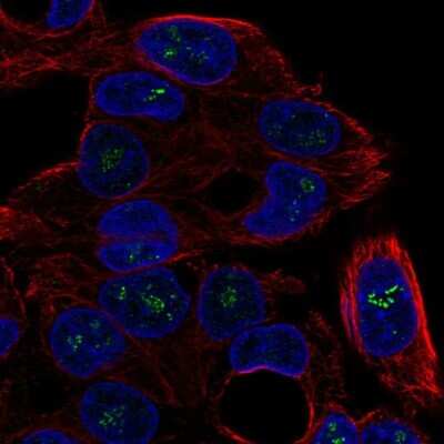 Immunocytochemistry/Immunofluorescence: ICK Antibody [NBP2-68573] - Staining of human cell line Hep G2 shows localization to nucleoli fibrillar center.