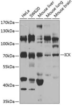 Western Blot: ICK Antibody [NBP3-04614] - Analysis of extracts of various cell lines, using ICK antibody at 1:1000 dilution. Secondary antibody: HRP Goat Anti-Rabbit IgG (H+L) at 1:10000 dilution. Lysates/proteins: 25ug per lane. Blocking buffer: 3% nonfat dry milk in TBST. Detection: ECL Basic Kit