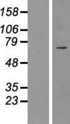 Western Blot: ICK Overexpression Lysate (Adult Normal) [NBP2-07029] Left-Empty vector transfected control cell lysate (HEK293 cell lysate); Right -Over-expression Lysate for ICK.