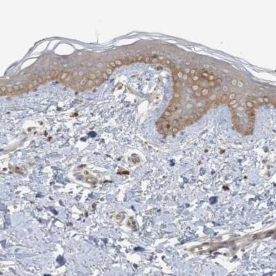 Immunohistochemistry-Paraffin: ICMT Antibody [NBP1-91795] - Staining of human skin shows moderate cytoplasm granular positivity in squamous epithelial cells.