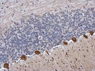 Immunohistochemistry-Paraffin: ICMT Antibody [NBP2-42865] - Analysis of rat hind brain. ICMT antibody dilution: 1:500.