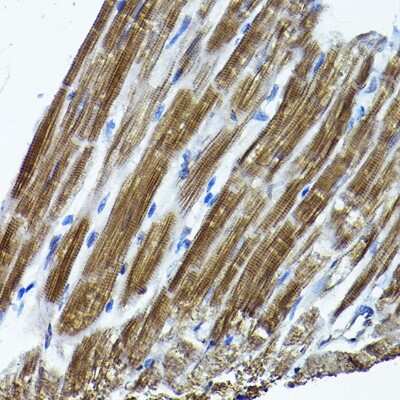 Immunohistochemistry-Paraffin: ICMT Antibody [NBP3-04787] - Immunohistochemistry of paraffin-embedded rat heart using ICMT Rabbit pAb (NBP3-04787) at dilution of 1:200 (40x lens). Perform high pressure antigen retrieval with 10 mM citrate buffer pH 6.0 before commencing with IHC staining protocol.