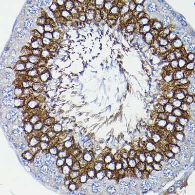 Immunohistochemistry-Paraffin: ICMT Antibody [NBP3-04787] - Immunohistochemistry of paraffin-embedded rat testis using ICMT Rabbit pAb (NBP3-04787) at dilution of 1:200 (40x lens). Perform high pressure antigen retrieval with 10 mM citrate buffer pH 6.0 before commencing with IHC staining protocol.