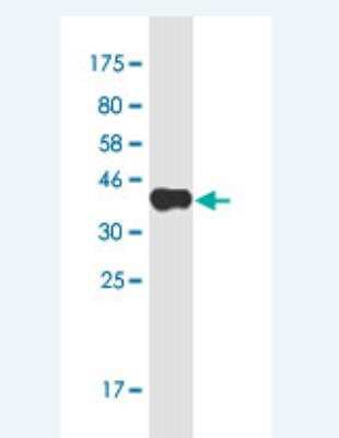 Western Blot: ICOS Antibody (3G4) [H00029851-M02-100ug] - Detection against Immunogen (38.83 KDa) .