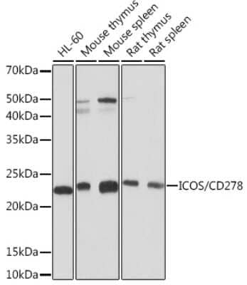 Western Blot: ICOS Antibody (7H1F7) [NBP3-16568] - Western blot analysis of extracts of various cell lines, using ICOS Rabbit mAb (NBP3-16568) at 1:1000 dilution. Secondary antibody: HRP Goat Anti-Rabbit IgG (H+L) at 1:10000 dilution. Lysates/proteins: 25ug per lane. Blocking buffer: 3% nonfat dry milk in TBST. Detection: ECL Basic Kit. Exposure time: 30s.