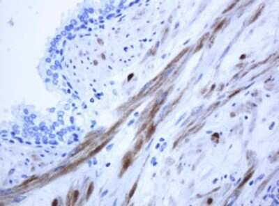 Immunohistochemistry: ICT Antibody (2F9) [NBP2-45747] - Analysis of Human prostate tissue. (Heat-induced epitope retrieval by 10mM citric buffer, pH6.0, 120C for 3min)