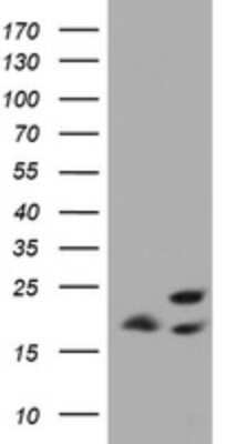 Western Blot: ICT Antibody (2F9) [NBP2-45747] - Analysis of HEK293T cells were transfected with the pCMV6-ENTRY control (Left lane) or pCMV6-ENTRY ICT.