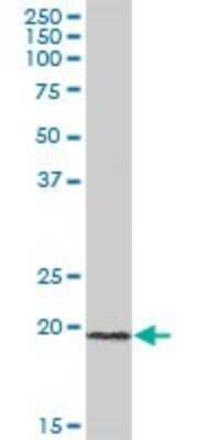 Western Blot: ICT Antibody [H00003396-B01P] - Analysis of ICT1 expression in human colon.