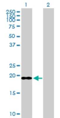 Western Blot: ICT Antibody [H00003396-D01P] - Analysis of ICT1 expression in transfected 293T cell line by ICT1 polyclonal antibody.Lane 1: ICT1 transfected lysate(23.60 KDa).Lane 2: Non-transfected lysate.