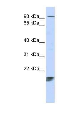 Western Blot: ICT Antibody [NBP1-55014] - Human Thymus lysate, concentration 0.2-1 ug/ml.