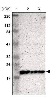 Western Blot: ICT Antibody [NBP1-87963] - Lane 1: Marker  [kDa] 220, 112, 84, 47, 32, 26, 17.  Lane 2: Human cell line RT-4.  Lane 3: Human cell line U-251MG sp