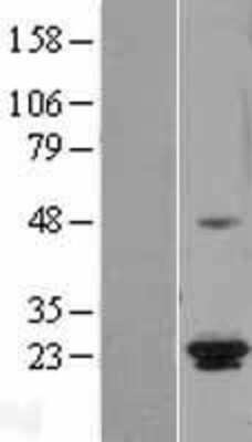 Western Blot: ICT Overexpression Lysate (Adult Normal) [NBL1-11812] Left-Empty vector transfected control cell lysate (HEK293 cell lysate); Right -Over-expression Lysate for ICT.