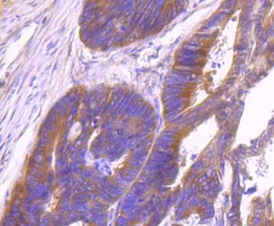 Immunohistochemistry-Paraffin: ID1 Antibody (JM92-13) [NBP2-66897] - Analysis of paraffin-embedded human colon tissue using anti-Id1 antibody. Counter stained with hematoxylin.