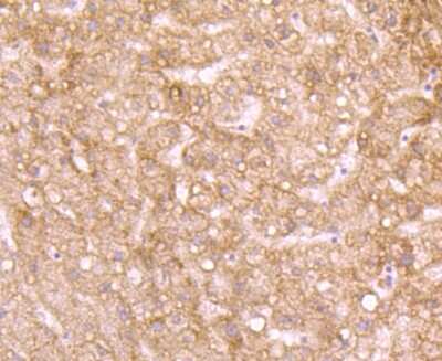 Immunohistochemistry-Paraffin: ID1 Antibody (JM92-13) [NBP2-66897] - Analysis of paraffin-embedded human liver tissue using anti-Id1 antibody. Counter stained with hematoxylin.