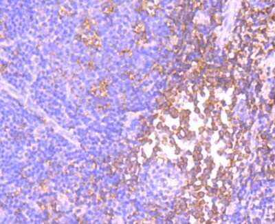 Immunohistochemistry-Paraffin: ID1 Antibody (JM92-13) [NBP2-66897] - Analysis of paraffin-embedded human tonsil tissue using anti-Id1 antibody. Counter stained with hematoxylin.