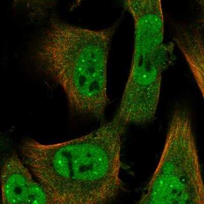 Immunocytochemistry/Immunofluorescence: ID2 Antibody [NBP1-88630] - Staining of human cell line U-251 MG shows localization to nucleoplasm, nuclear bodies & cytosol. Antibody staining is shown in green.