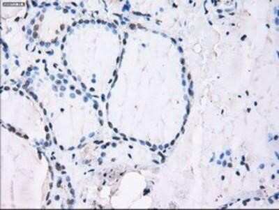 Immunohistochemistry: ID3 Antibody (OTI8B3) - Azide and BSA Free [NBP2-70979] - Staining of paraffin-embedded Human thyroid tissue using anti-ID3 mouse monoclonal antibody.