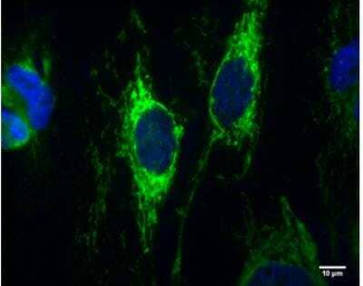 Immunocytochemistry/Immunofluorescence: IDH2 Antibody (673) [NBP2-43572] - HeLa cells were fixed in 4% paraformaldehyde at RT for 10 min. Green: IDH2 protein stained by IDH2 antibody [GT673]  diluted at 1:100.Blue: Hoechst 33342 staining.Scale bar = 10 um.