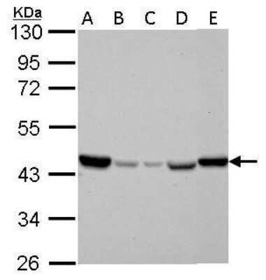 Western Blot: IDH2 Antibody (673) [NBP2-43572] - Analysis of A. 30 ug Jurkat whole cell lysate/extract B. 30 ug Raji whole cell lysate/extract C. 30 ug K562 whole cell lysate/extract D. 30 ug THP-1 whole cell lysate/extract E. 30 ug NCI-H929 whole cell lysate/extract 10 % SDS-PAGE IDH2 antibody dilution: 1:1000