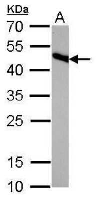 Western Blot: IDH2 Antibody (673) [NBP2-43572] - Analysis of A. 50 ug rat brain lysate/extract 12 % SDS-PAGE IDH2 antibody [673] dilution: 1:1000