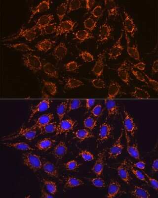 Immunocytochemistry/Immunofluorescence: IDH2 Antibody (8C3D4) [NBP3-15366] - Immunofluorescence analysis of C6 cells using IDH2 Rabbit mAb (NBP3-15366) at dilution of 1:100 (40x lens). Blue: DAPI for nuclear staining.