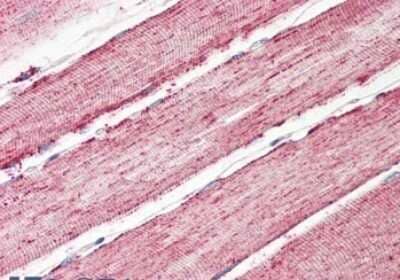 Immunohistochemistry-Paraffin: IDH2 Antibody [NBP1-52117] - 3.75ug/ml staining of paraffin embedded Human Skeletal Muscle. Steamed antigen retrieval with citrate buffer pH 6, AP-staining.