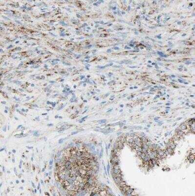 Immunohistochemistry-Paraffin: IDH2 Antibody [NBP1-85784] - Staining of human prostate shows moderate to granular cytoplasmic positivity in smooth muscle cells.