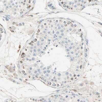Immunohistochemistry-Paraffin: IDH2 Antibody [NBP1-85784] - Staining of human testis shows weak to moderate granular cytoplasmic positivity in a small subset of cells in seminiferous ducts.