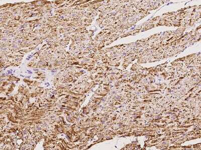 Immunohistochemistry-Paraffin: IDH2 Antibody [NBP2-97768] - Immunochemical staining of human IDH2 in human stomach with rabbit polyclonal antibody at 1:100 dilution, formalin-fixed paraffin embedded sections.
