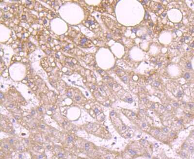 Immunohistochemistry-Paraffin: IDH2 Antibody (JA55-31) [NBP2-66899] - Analysis of paraffin-embedded human liver tissue using anti-IDH2 antibody. Counter stained with hematoxylin.