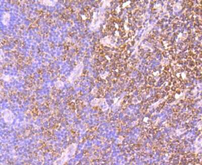 Immunohistochemistry-Paraffin: IDH2 Antibody (JA55-31) [NBP2-66899] - Analysis of paraffin-embedded human tonsil tissue using anti-IDH2 antibody. Counter stained with hematoxylin.