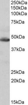 Western Blot: IDH2 Antibody [NBP1-52117] - Analysis of IDH2 in Human Heart lysate (35ug protein in RIPA buffer) using NBP1-52117 at 0.1 ug/ml. Primary incubation was 1 hour. Detected by chemiluminescence.