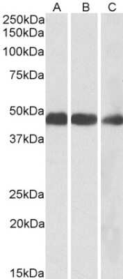 Western Blot: IDH2 Antibody [NBP1-52117] - 0.1ug/ml staining of Mouse (A), Rat (B) and Pig (C) Heart lysates (35ug protein in RIPA buffer). Detected by chemiluminescence.