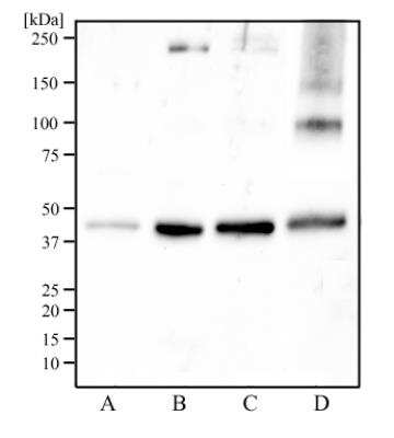 Western Blot: IDH2 Antibody [NBP2-22166] - Analysis of Caki-1 cell lysate (A), human skeletal muscle tissue (B), mouse skeletal muscle tissue (C), and rat skeletal muscle tissue (D) using IDH2 antibody at a concentration of 2 ug/mL.