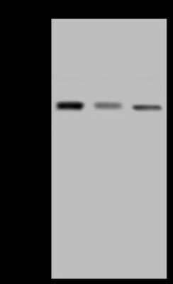 Western Blot: IDH2 Antibody [NBP2-97768] - Anti-IDH2 rabbit polyclonal antibody at 1:500 dilution. Lane A: K562 Whole Cell Lysate Lane B: HepG2 Whole Cell Lysate Lane C: MOLT-4 Whole Cell Lysate Lysates/proteins at 30 ug per lane. Secondary Goat Anti-Rabbit IgG (H+L)/HRP at 1/10000 dilution. Developed using the ECL technique. Performed under reducing conditions. Predicted band size: 51 kDa. Observed band size: 45 kDa