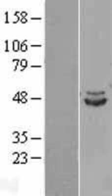 Western Blot: IDH2 Overexpression Lysate (Adult Normal) [NBL1-11818] Left-Empty vector transfected control cell lysate (HEK293 cell lysate); Right -Over-expression Lysate for IDH2.