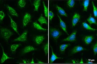 Immunocytochemistry/Immunofluorescence: IDH3A Antibody [NBP1-32396] - HeLa cells were fixed in ice-cold MeOH for 5 min. Green: IDH3A stained by IDH3A antibody diluted at 1:500. Blue: Hoechst 33342 staining. Scale bar= 10 um.