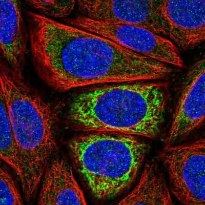 <b>Independent Antibodies Validation. </b>Immunocytochemistry/Immunofluorescence: IDH3A Antibody [NBP2-57139] - Staining of human cell line SiHa shows localization to mitochondria.