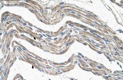 Immunohistochemistry-Paraffin: IDH3A Antibody [NBP1-54736] - Human Muscle Tissue, Skeletal muscle cells (Indicated with Arrows) 4-8ug/ml.