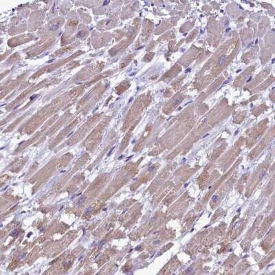 Immunohistochemistry-Paraffin: IDH3A Antibody [NBP1-85840] - Staining of human Heart muscle shows moderate granular cytoplasmic positivity in cardiomyocytes.