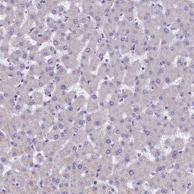 Immunohistochemistry-Paraffin: IDH3A Antibody [NBP1-85840] - Staining of human Liver shows very weak granular cytoplasmic positivity in hepatocytes.