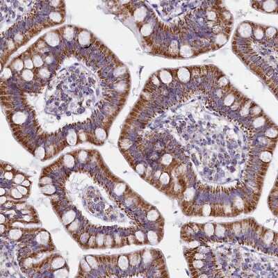 Immunohistochemistry-Paraffin: IDH3A Antibody [NBP1-85840] - Staining of human Small intestine shows strong granular cytoplasmic positivity in glandular cells.