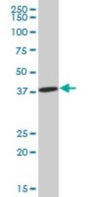 Western Blot: IDH3A Antibody [H00003419-B01P] - Analysis of IDH3A expression in rat brain.