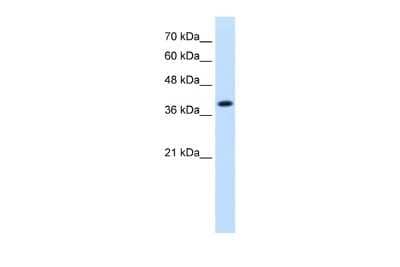 Western Blot: IDH3A Antibody [NBP1-54736] - Reccomended Titration: 1.25 ug/ml Positive Control: Jurkat cell lysate IDH3A is strongly supported by BioGPS gene expression data to be expressed in Human Jurkat cells