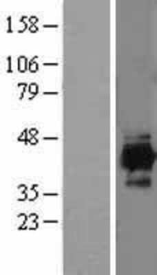 Western Blot: IDH3A Overexpression Lysate (Adult Normal) [NBL1-11819] Left-Empty vector transfected control cell lysate (HEK293 cell lysate); Right -Over-expression Lysate for IDH3A.