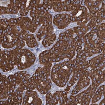 Immunohistochemistry-Paraffin: IDH3B Antibody [NBP2-14114] - Staining of human parathyroid gland shows strong granular cytoplasmic positivity in glandular cells.