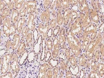 Immunohistochemistry-Paraffin: IDH3B Antibody [NBP2-97467] - Immunochemical staining of human IDH3B in human colon with rabbit polyclonal antibody at 1:100 dilution, formalin-fixed paraffin embedded sections.