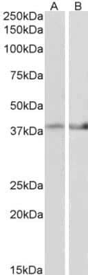 Western Blot: IDH3B Antibody [NBP1-78787] - Staining of Mouse Heart (A) and Mouse Muscle (B) lysate (35 ug protein in RIPA buffer). Primary incubation was 1 hour. Detected by chemiluminescence.