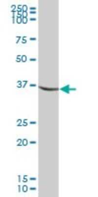 Western Blot: IDH3G Antibody [H00003421-B01P] - Analysis of IDH3G expression in rat brain.